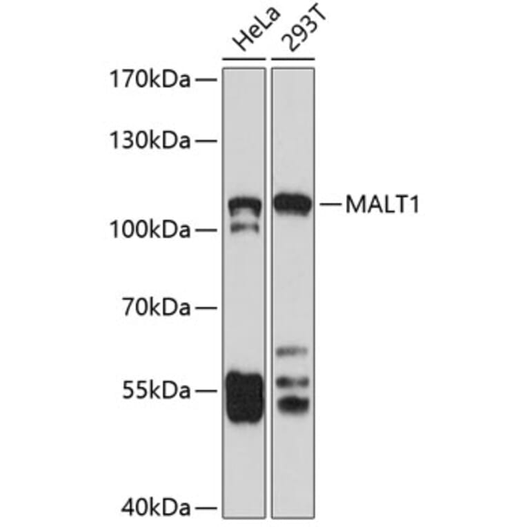 Western Blot - Anti-MALT1/MLT Antibody (A13907) - Antibodies.com