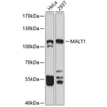 Western Blot - Anti-MALT1/MLT Antibody (A13907) - Antibodies.com