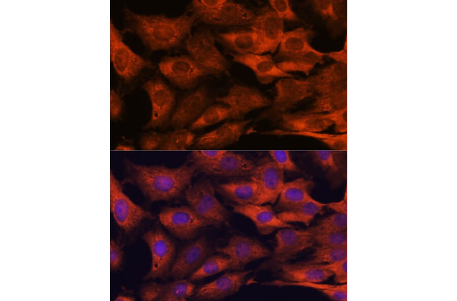 Immunofluorescence - Anti-MALT1/MLT Antibody (A13907) - Antibodies.com