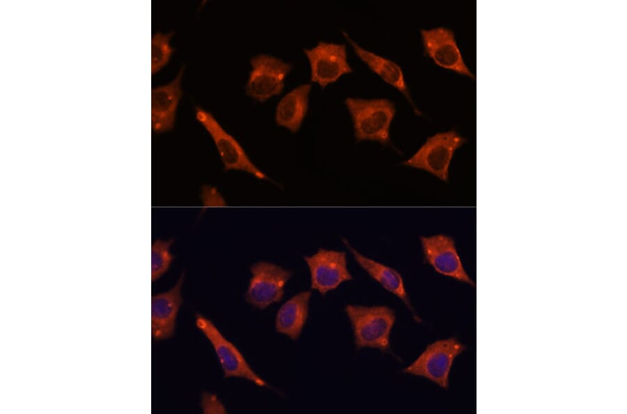 Immunofluorescence - Anti-MALT1/MLT Antibody (A13907) - Antibodies.com