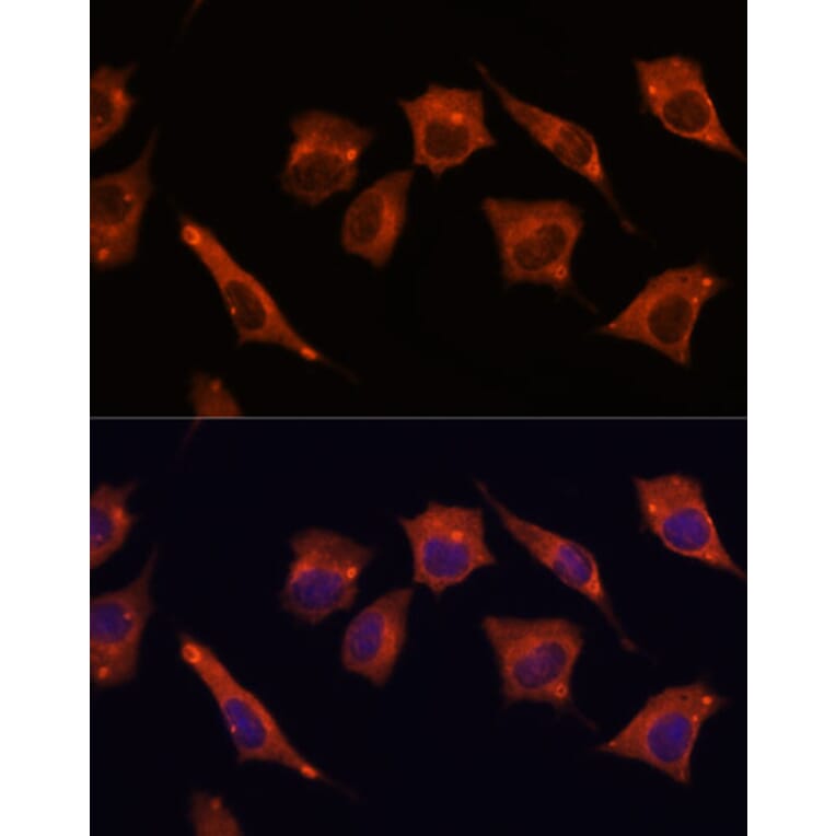 Immunofluorescence - Anti-MALT1/MLT Antibody (A13907) - Antibodies.com
