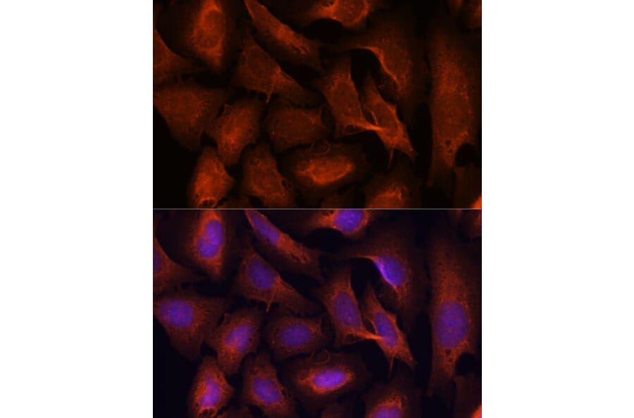 Immunofluorescence - Anti-MALT1/MLT Antibody (A13907) - Antibodies.com