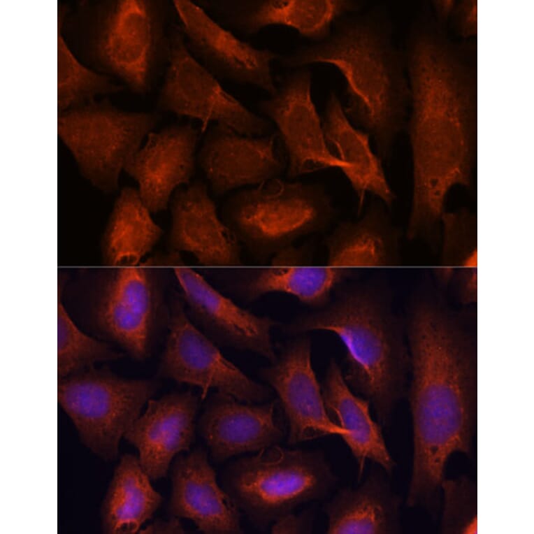 Immunofluorescence - Anti-MALT1/MLT Antibody (A13907) - Antibodies.com