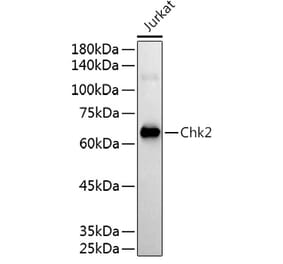 Western Blot - Anti-Chk2 Antibody (A13908) - Antibodies.com