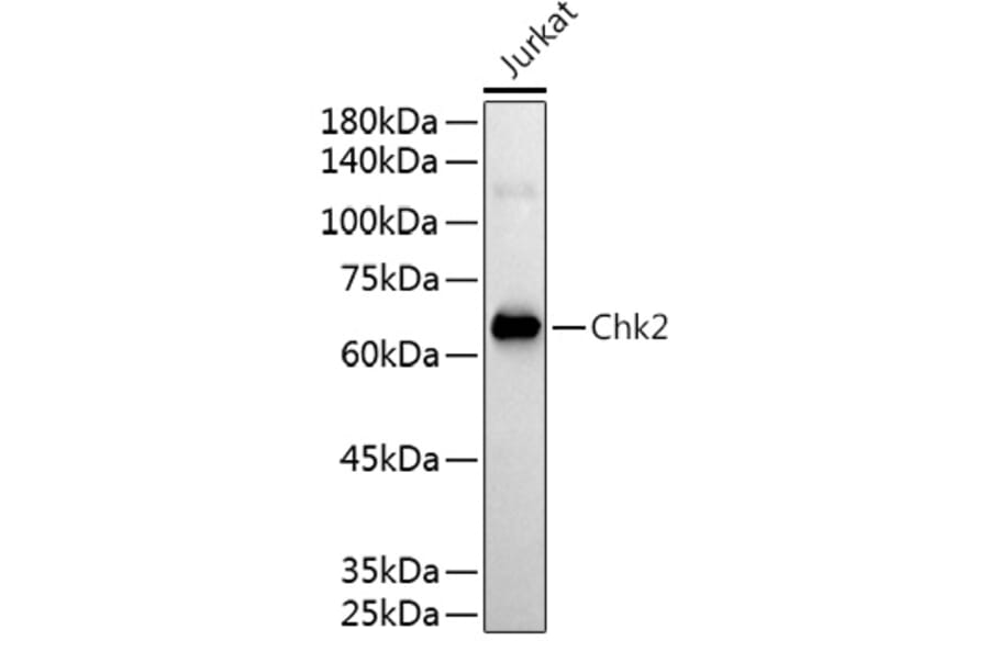 Western Blot - Anti-Chk2 Antibody (A13908) - Antibodies.com