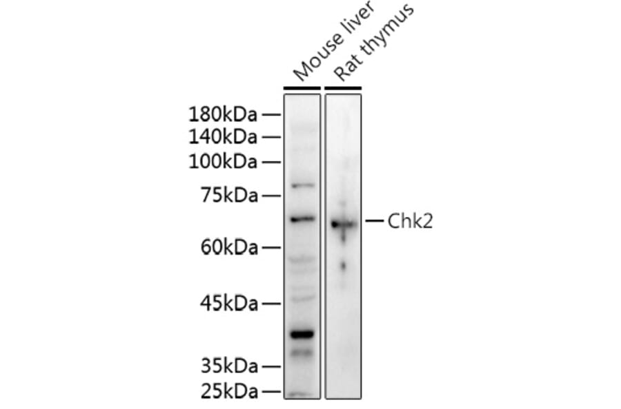 Western Blot - Anti-Chk2 Antibody (A13908) - Antibodies.com