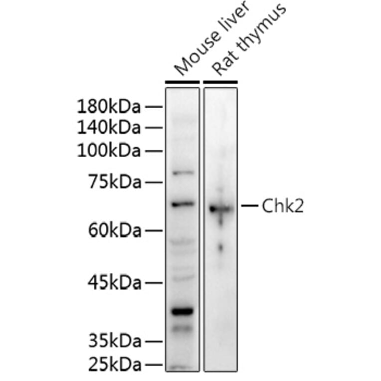 Western Blot - Anti-Chk2 Antibody (A13908) - Antibodies.com