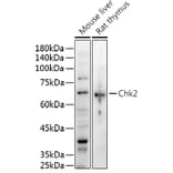 Western Blot - Anti-Chk2 Antibody (A13908) - Antibodies.com