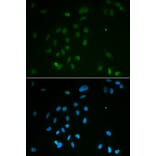 Immunofluorescence - Anti-Chk2 Antibody (A13908) - Antibodies.com