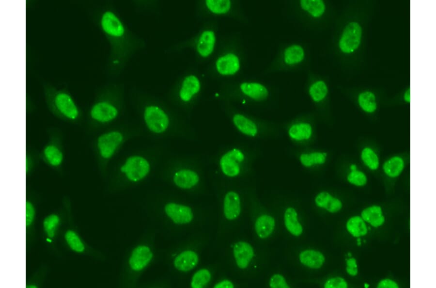 Immunofluorescence - Anti-Chk2 Antibody (A13908) - Antibodies.com