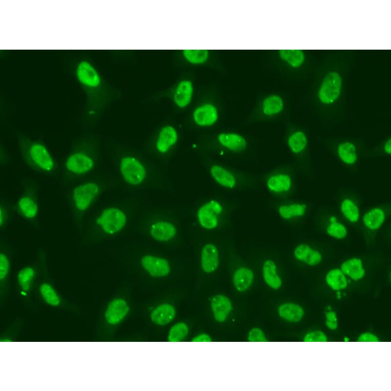 Immunofluorescence - Anti-Chk2 Antibody (A13908) - Antibodies.com