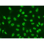 Immunofluorescence - Anti-Chk2 Antibody (A13908) - Antibodies.com