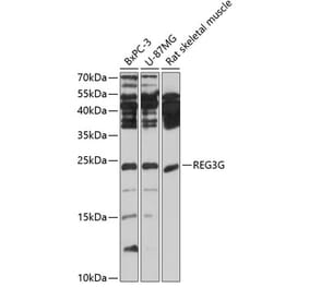 Western Blot - Anti-REG3G Antibody (A13909) - Antibodies.com