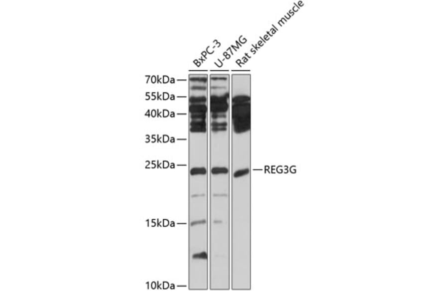 Western Blot - Anti-REG3G Antibody (A13909) - Antibodies.com