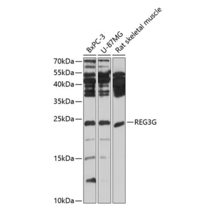 Western Blot - Anti-REG3G Antibody (A13909) - Antibodies.com