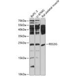 Western Blot - Anti-REG3G Antibody (A13909) - Antibodies.com