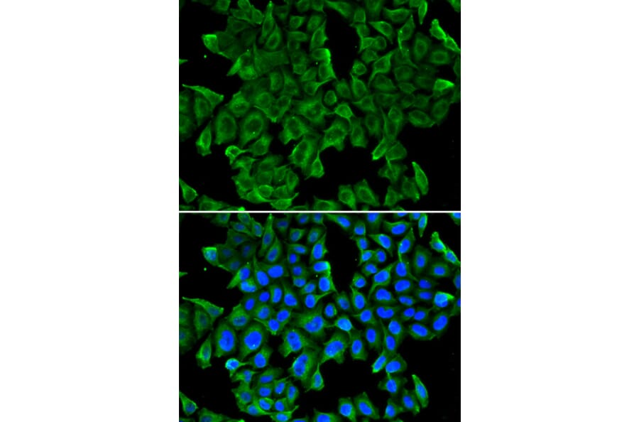 Immunofluorescence - Anti-REG3G Antibody (A13909) - Antibodies.com