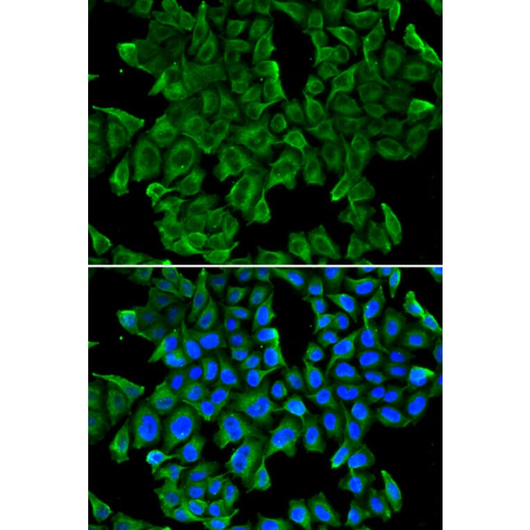 Immunofluorescence - Anti-REG3G Antibody (A13909) - Antibodies.com