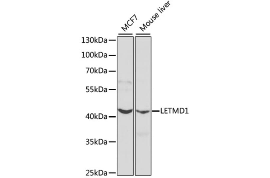 Western Blot - Anti-LETMD1/HCCR-1 Antibody (A13910) - Antibodies.com