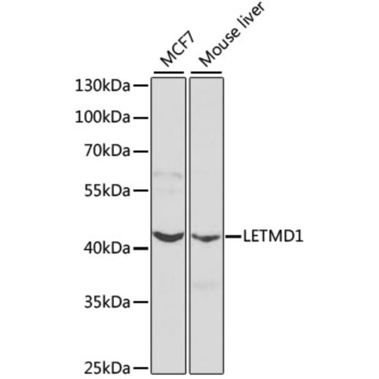 Western Blot - Anti-LETMD1/HCCR-1 Antibody (A13910) - Antibodies.com