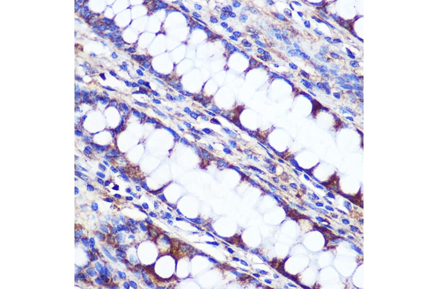 Immunohistochemistry - Anti-LETMD1/HCCR-1 Antibody (A13910) - Antibodies.com