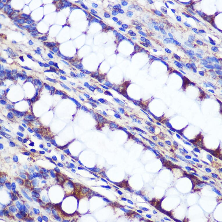 Immunohistochemistry - Anti-LETMD1/HCCR-1 Antibody (A13910) - Antibodies.com