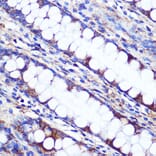 Immunohistochemistry - Anti-LETMD1/HCCR-1 Antibody (A13910) - Antibodies.com