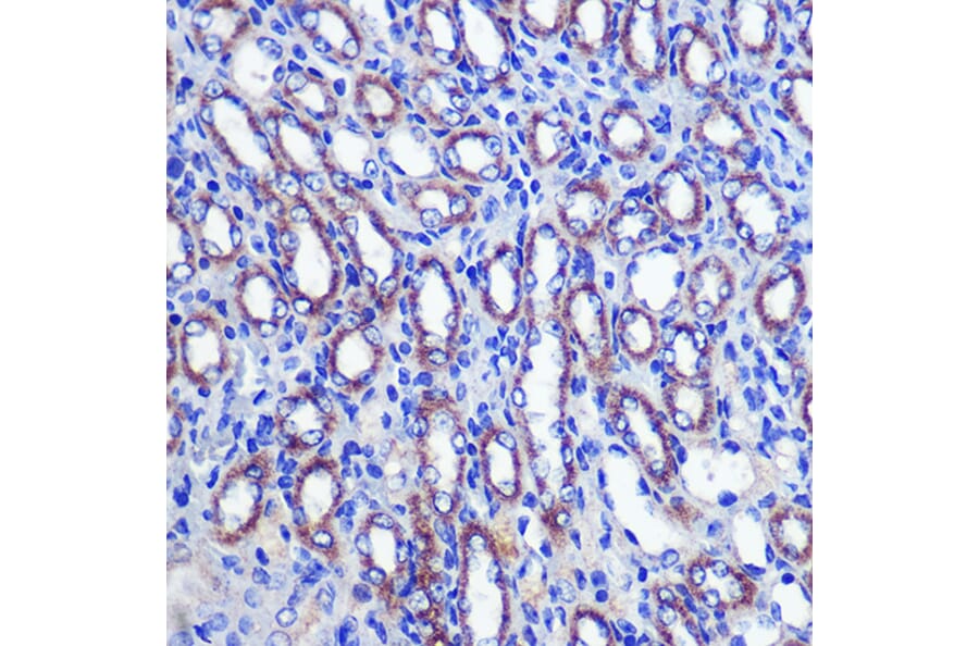 Immunohistochemistry - Anti-LETMD1/HCCR-1 Antibody (A13910) - Antibodies.com