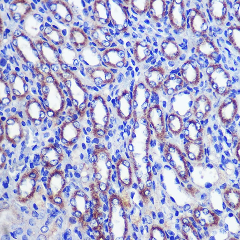 Immunohistochemistry - Anti-LETMD1/HCCR-1 Antibody (A13910) - Antibodies.com