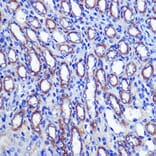 Immunohistochemistry - Anti-LETMD1/HCCR-1 Antibody (A13910) - Antibodies.com