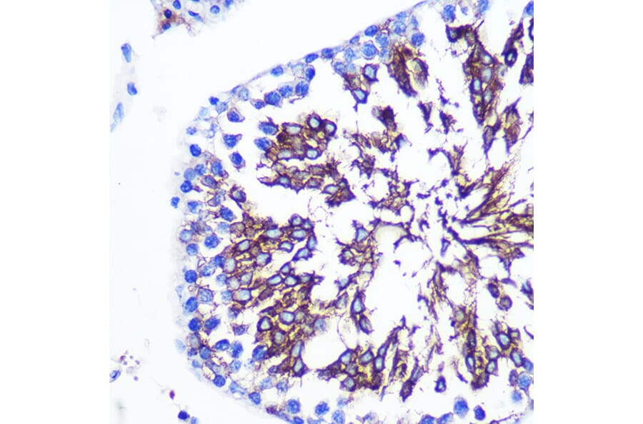 Immunohistochemistry - Anti-LETMD1/HCCR-1 Antibody (A13910) - Antibodies.com