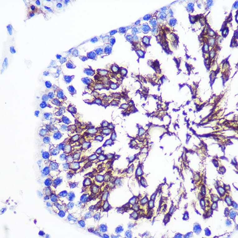 Immunohistochemistry - Anti-LETMD1/HCCR-1 Antibody (A13910) - Antibodies.com