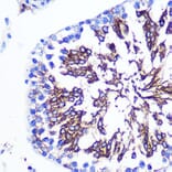 Immunohistochemistry - Anti-LETMD1/HCCR-1 Antibody (A13910) - Antibodies.com