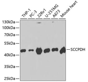 Western Blot - Anti-SCCPDH Antibody (A13911) - Antibodies.com