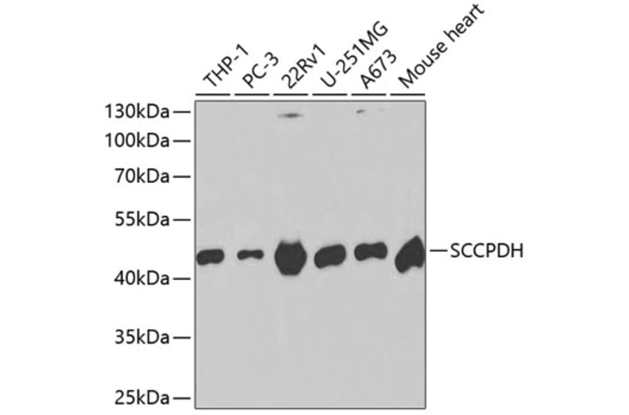 Western Blot - Anti-SCCPDH Antibody (A13911) - Antibodies.com