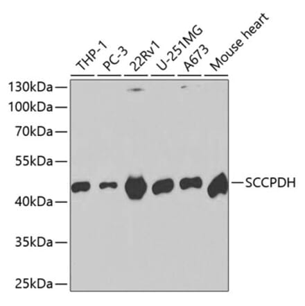 Western Blot - Anti-SCCPDH Antibody (A13911) - Antibodies.com