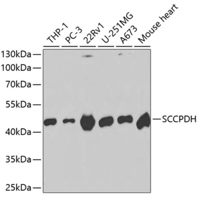 Western Blot - Anti-SCCPDH Antibody (A13911) - Antibodies.com