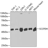 Western Blot - Anti-SCCPDH Antibody (A13911) - Antibodies.com
