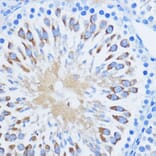 Immunohistochemistry - Anti-PIWIL1 Antibody (A13912) - Antibodies.com