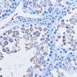 Immunohistochemistry - Anti-PIWIL1 Antibody (A13912) - Antibodies.com