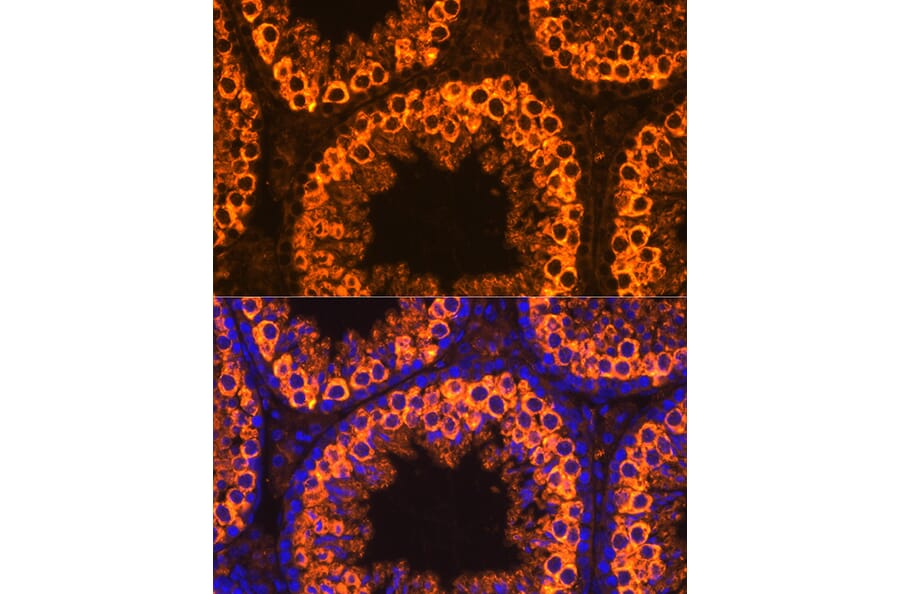 Immunofluorescence - Anti-PIWIL1 Antibody (A13912) - Antibodies.com