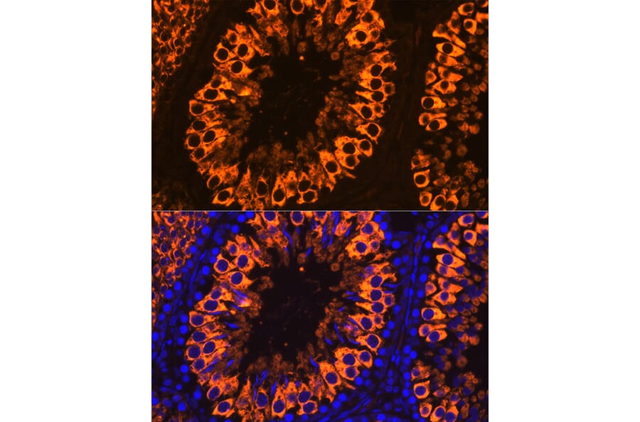 Immunofluorescence - Anti-PIWIL1 Antibody (A13912) - Antibodies.com