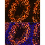 Immunofluorescence - Anti-PIWIL1 Antibody (A13912) - Antibodies.com
