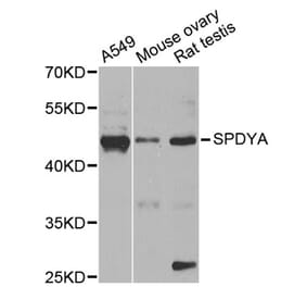 Western Blot - Anti-SPDYA Antibody (A2153) - Antibodies.com