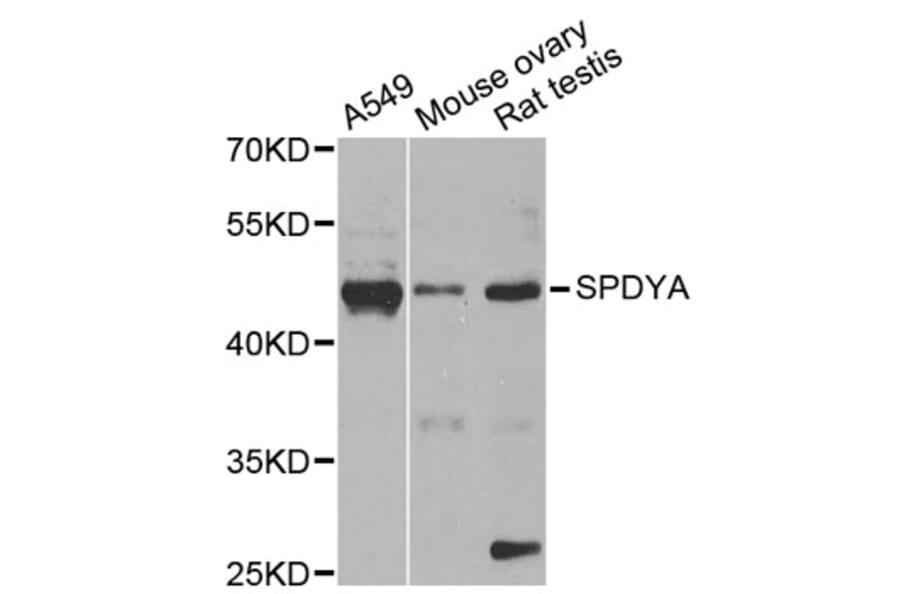 Western Blot - Anti-SPDYA Antibody (A2153) - Antibodies.com
