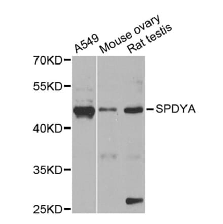 Western Blot - Anti-SPDYA Antibody (A2153) - Antibodies.com