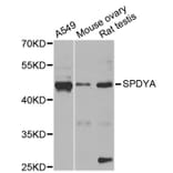 Western Blot - Anti-SPDYA Antibody (A2153) - Antibodies.com