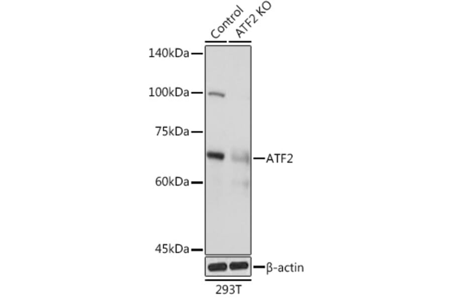 Western Blot - Anti-ATF2 Antibody (A13915) - Antibodies.com