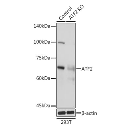 Western Blot - Anti-ATF2 Antibody (A13915) - Antibodies.com