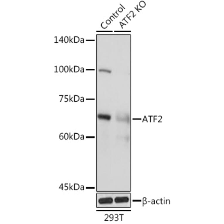 Western Blot - Anti-ATF2 Antibody (A13915) - Antibodies.com